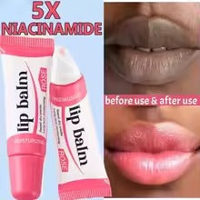 5X Niacinamide Lip Balm – Moisturizing Lip Care